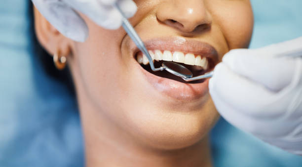 Best Emergency Dental Extractions in Oak Bluffs, MA
