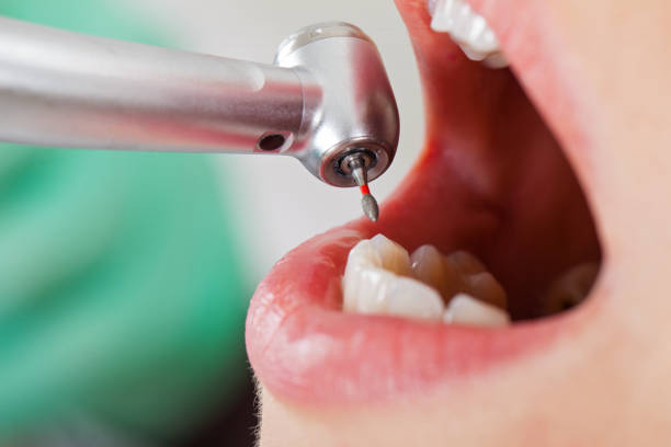 Best Mobile Emergency Dentist in Oak Bluffs, MA